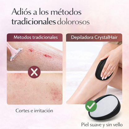 Comparativa entre depilación tradicional con irritación y depiladora CrystalHair con piel suave
